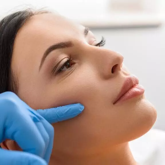Cheekbone filler