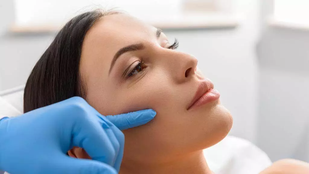 Cheekbone filler